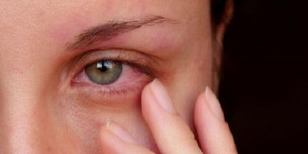 كيف تؤثر الهرمونات على صحة عينيك؟ تفاصيل قد تُفاجئك - اخبارك الان
