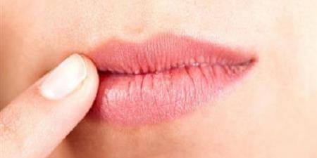 تشقق الشفاه .. مؤشر جمالي أم إنذار صحي؟ - اخبارك الان