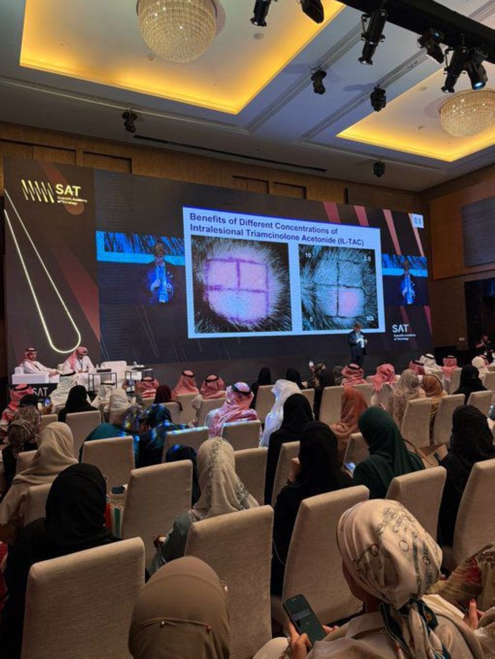 750 طبيبًا يناقشون علاج تساقط الشعر في الرياض