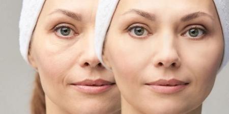 7 أسباب تؤدي إلى انتفاخ الوجه - اخبارك الان