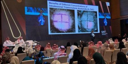 بمشاركة عالمية.. 750 طبيبًا يناقشون علاج تساقط الشعر في الرياض - اخبارك الان