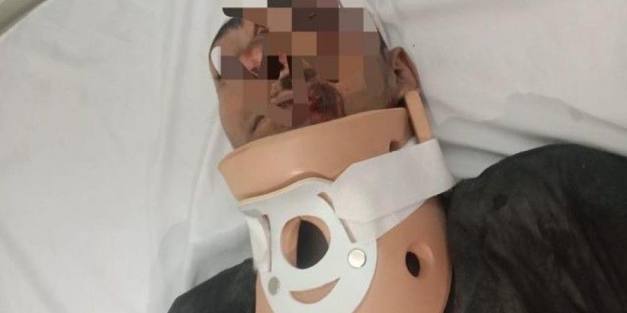 صحة الدقهلية: نجاح جراحة دقيقة لإصلاح كسر بالرقبة في تمى الأمديد - اخبارك الان